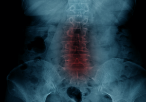 sciatic nerve scan
