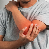 Tennis Elbow